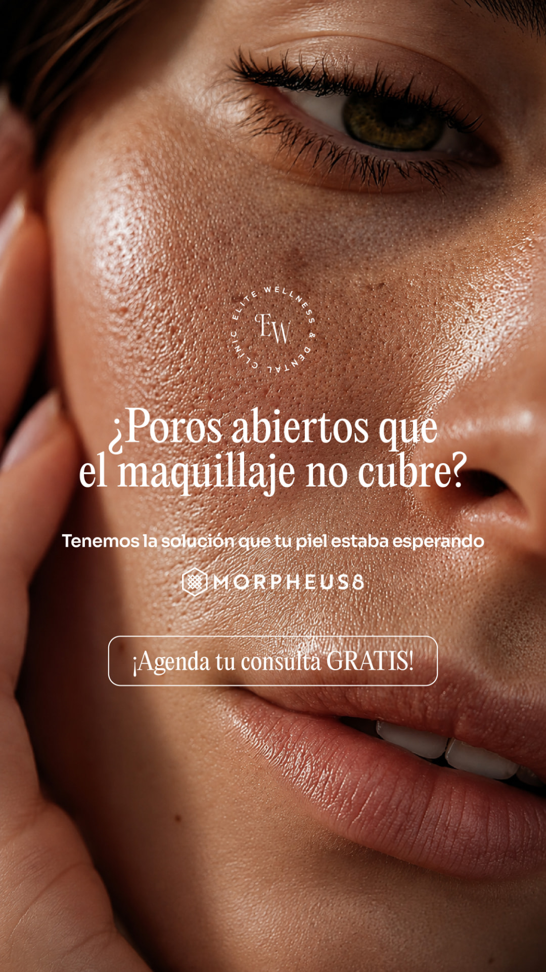 Elite Wellness Morpheus8 skin treatment ad